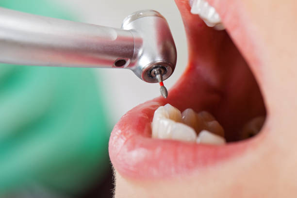 Best Weekend Emergency Dentist in Valley Springs, CA